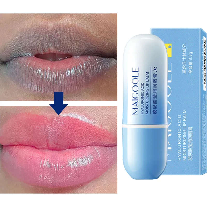 Hyaluronic Acid Remove Dark Lip Balm Whitening Moisturizing Cream Exfoliating Dead Skin Lightening Pigment Care Beauty Health