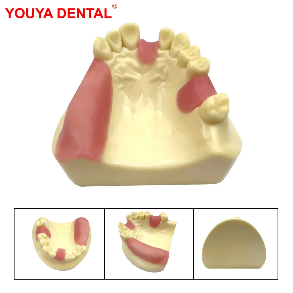 

1pcs Dental Implant Model Practice Teeth Model For Dental Students Dentist Training Studying Examation Teeth Teaching Model Demo