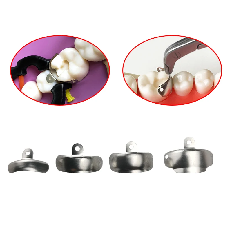 Bandes De Matrice Dentaire Métalliques - Système Profilé V3 Avec Anneaux De Serrage - Universel