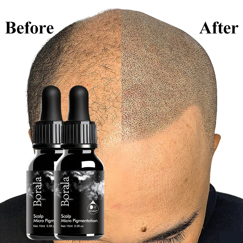 Tattoo Ink Tattoo Ink Pigment BORALA Scalp Micropigmentation Permanent Makeup Professional Microblading Pigments for Hairline SMP Tattoo Inks Supplies