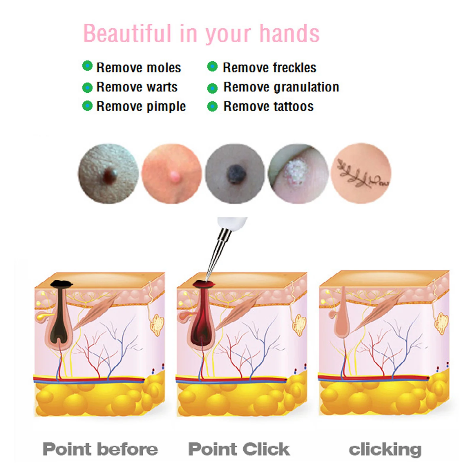 Handheld Freckle Removal Pen Mole Remover Pen 12 Gears LCD Screen Freckle Removal Skin Spots Beauty with Cotton Swab