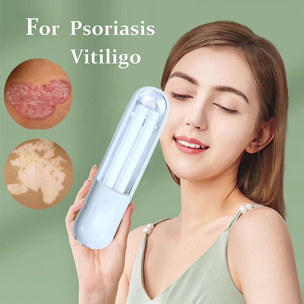 UVB 광선 요법 좁은 자외선 광선 요법 램프, 백반증 건선 치료, 311nm AliExpress