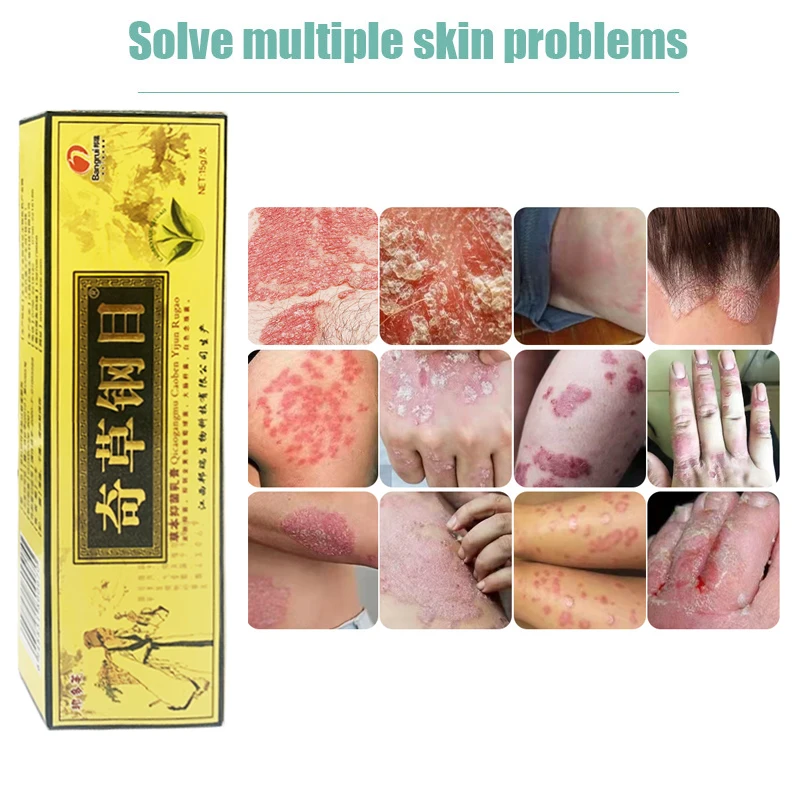 

15G Natural Psoriasis Treat Ointment Eczema Antibacterial Care Cream Dermatitis Eczematoid Skin Antipruritic Medical Dressing