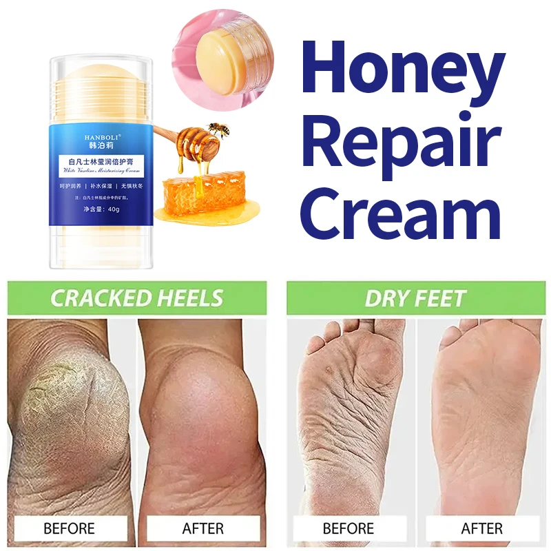 

Anti Crack Drying Foot Cream Cracked Feet Repair Hand Heel Dead Dry Skin Peeling Removal Mask Moisturizing Emollient Care 40g