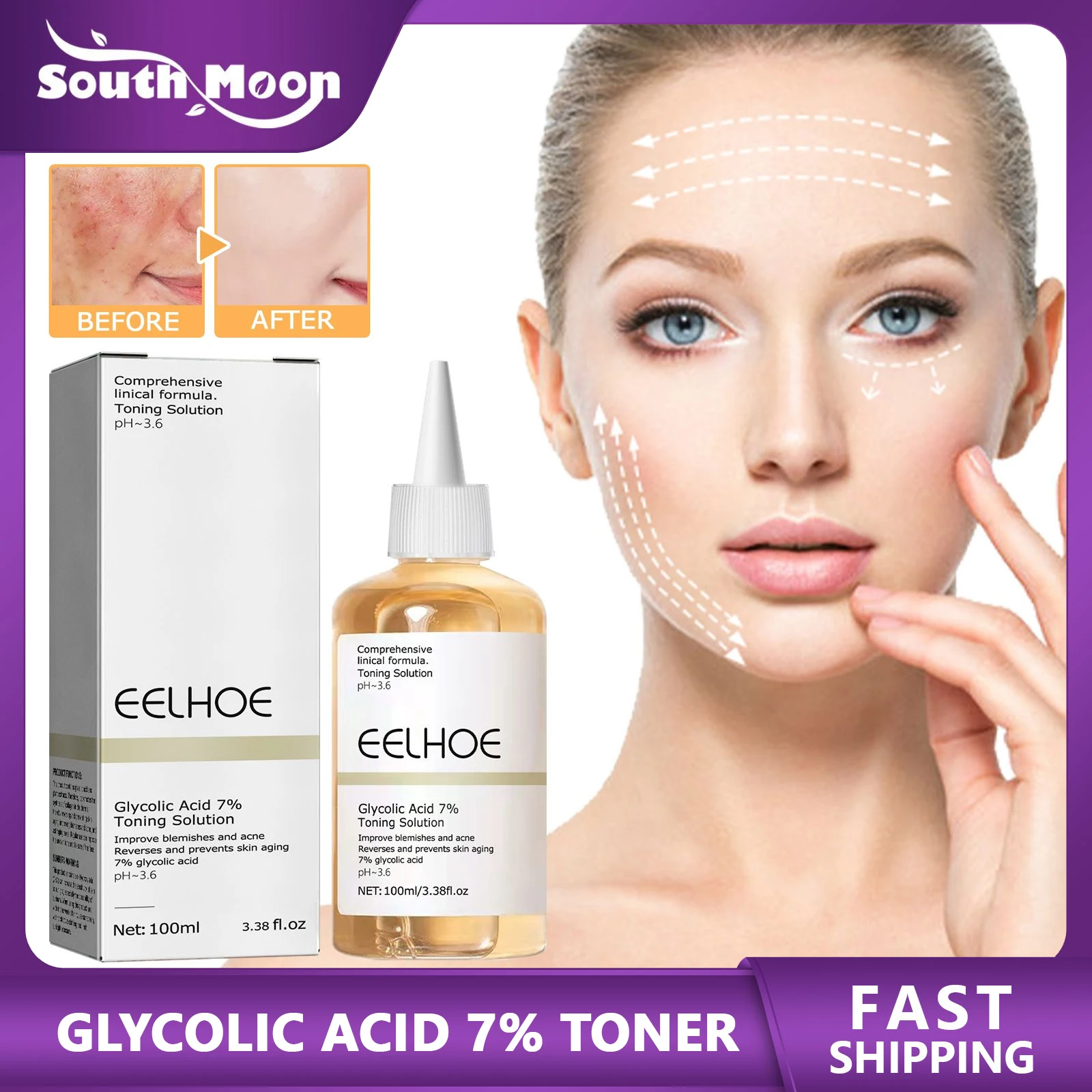 Facial Toner Acne Treatment Blemish Mark Removal Improve Dullness