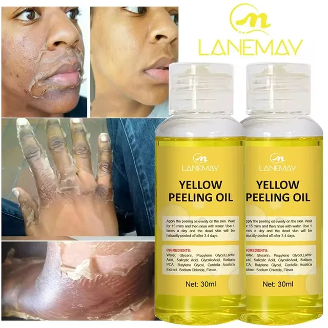 Yellow Peeling Oil Bleach Dark Skin Whiten Lotion Lighten Body Elbow Knee 1