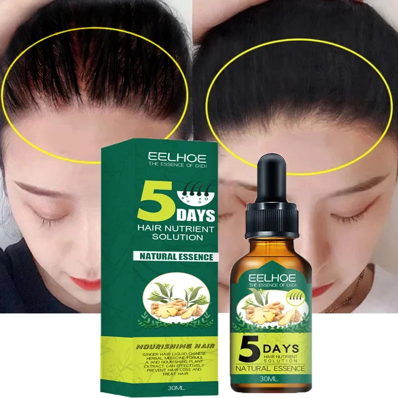 

Natural Ginger Hair Growth Essential Oil Fast Regrowth Anti Hair Loss Scalp Damaged Treatment Cream Hair Growth Care Products