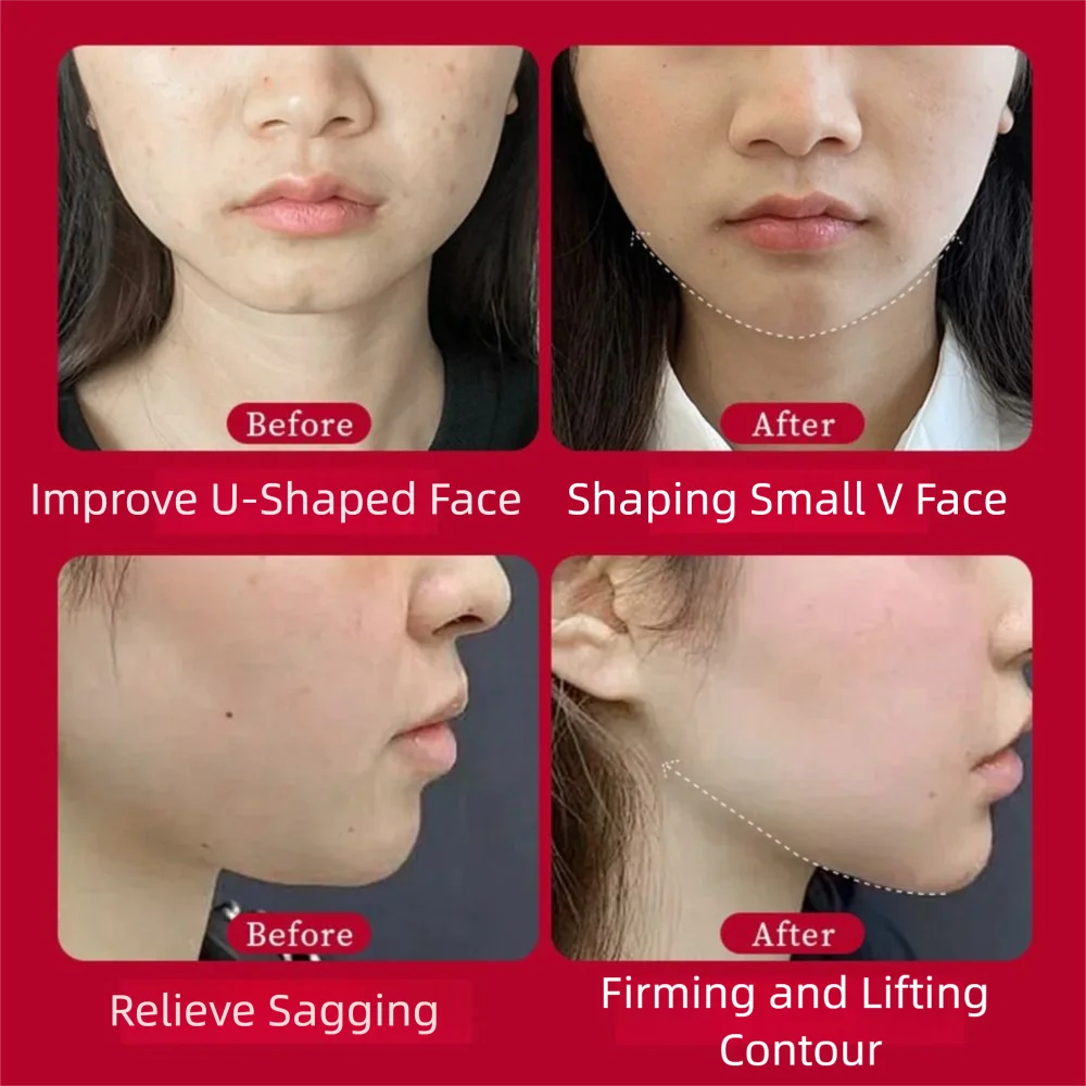 5개입/팩 V라인 페이셜 리프팅 마스크 V라인 탄력 소프트 젤 얇은 페이스 마스크 뷰티 도구 저자극성 페이스 리프트 마스크