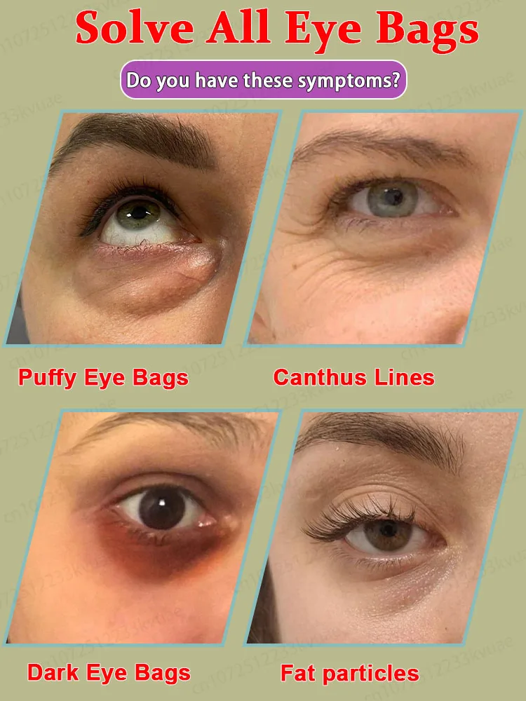 Eye Bag Killer Eliminates 99.9% of eye bags with centella asiatica and aloevera extracts to improve the skin around the eyes