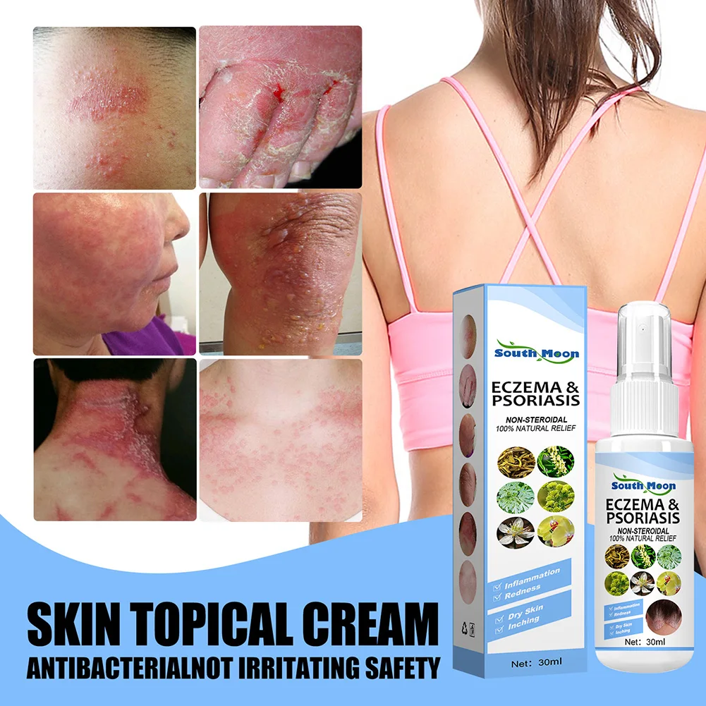 30ml Skin Psoriasis Spray Natural Herb Eczema Treatment Spray Itch Relief Improve Redness Dermatitis Psoriasis Health Care