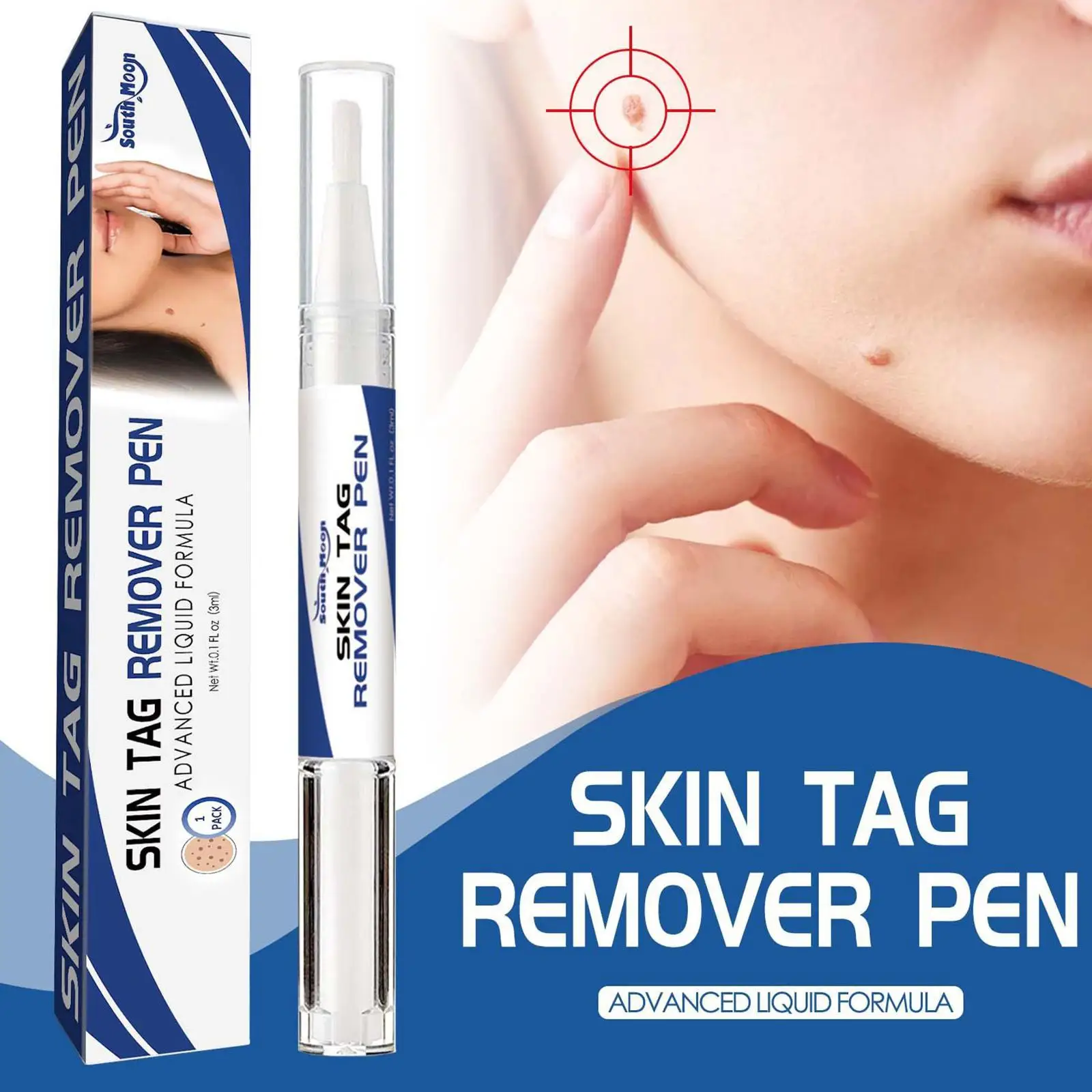 Skin Tags Remover Pen Rubber Bands Beauty Health Mole Wart Removal Patches Micro Skin For Face