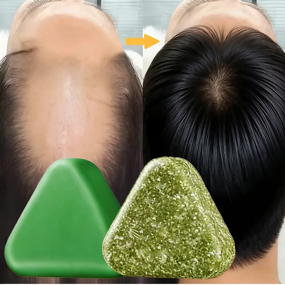 Shampoing à base de plantes naturelles, savon fait à la main, nourrissant, contrôle de l'huile, soin capillaire rafraîchissant, moelleux et apaisant 1 Shampoing à base de plantes naturelles, savon fait à la main, nourrissant, contrôle de l'huile, soin capillaire rafraîchissant, moelleux et apaisant 1
