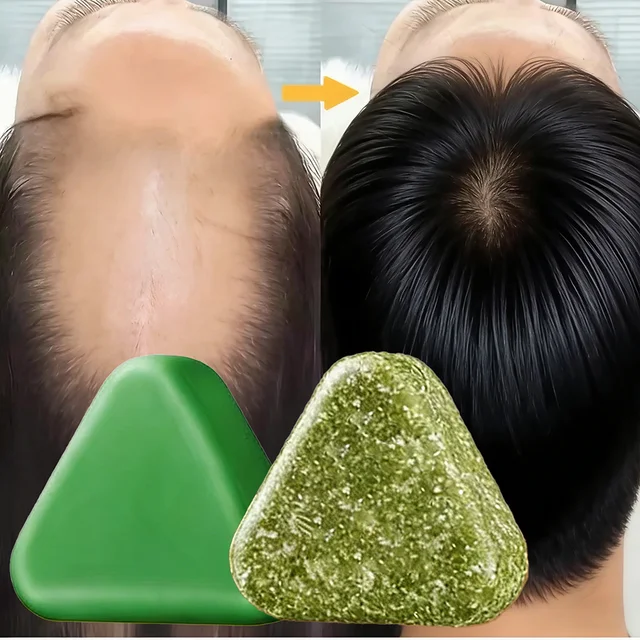 Shampoing à base de plantes naturelles, savon fait à la main, nourrissant, contrôle de l'huile, soin capillaire rafraîchissant, moelleux et apaisant 1