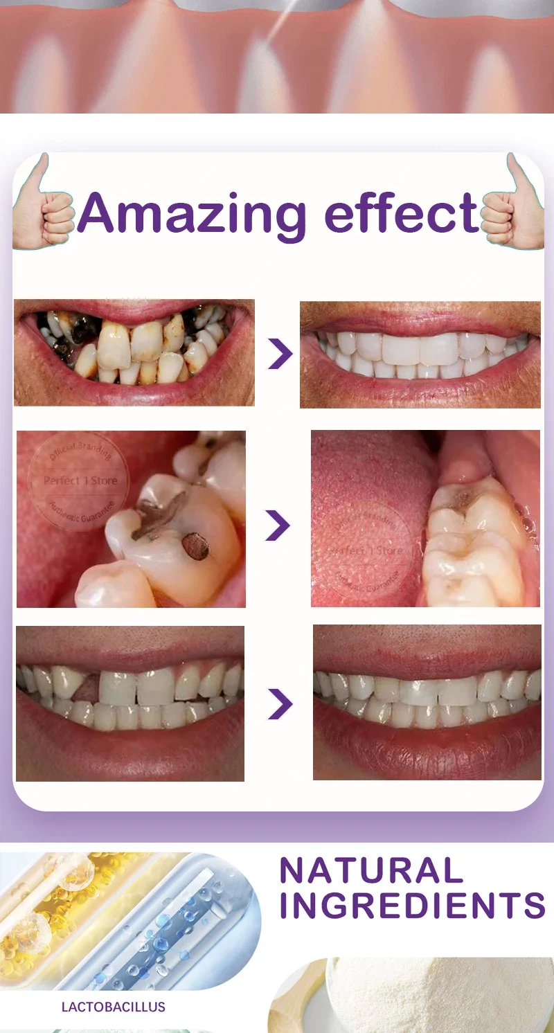 Dental Caries Repair Serum Prevent Tooth Decay Protect Teeth Remove