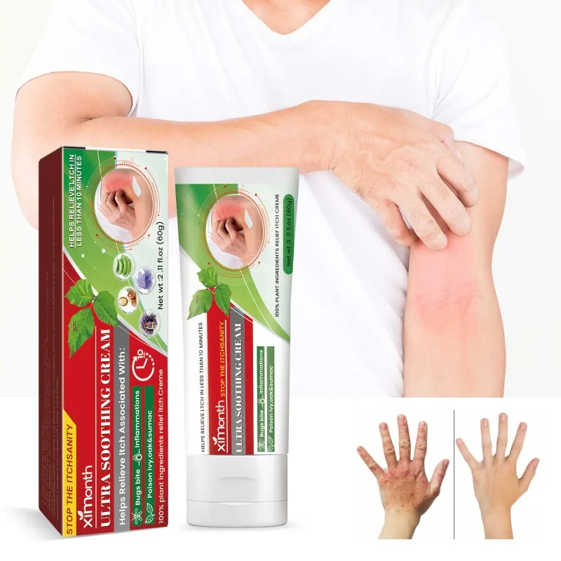 

Skin anti itching cream relieve mosquito bites prickly heat red itchy skin hands feet lasting Antipruritic body care ointment