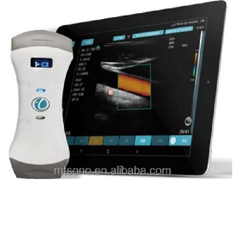 

Wireless Ultrasound Probes Doppler Ultrasound Scanner