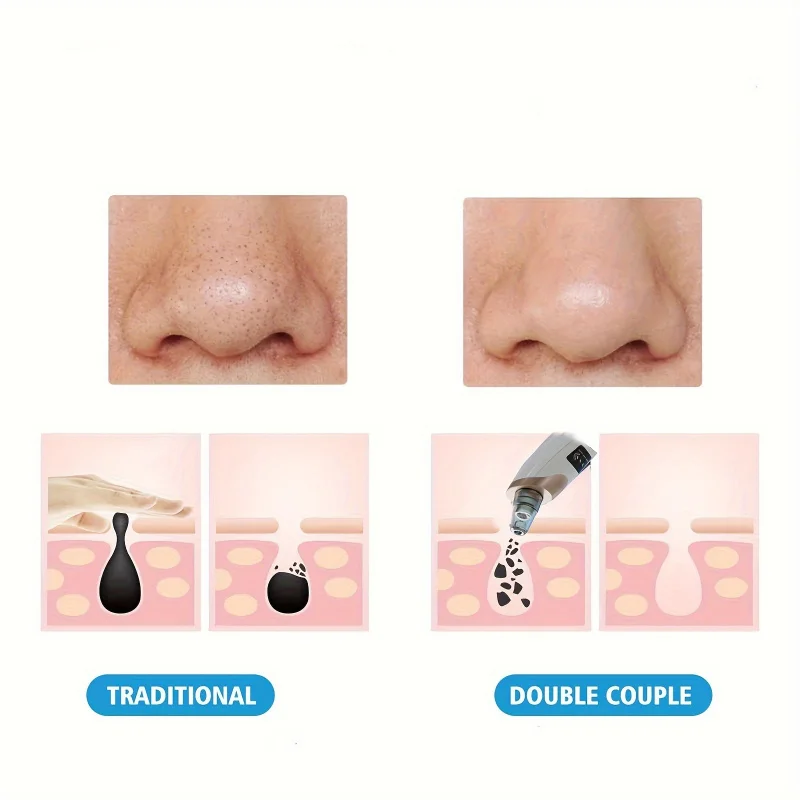 Blackhead Remover Facial Pore Cleanser Acne Remover Blackhead Remover Pore Vacuum 5 Suction USB Rejected Facial Pore Cleaner Kit For Adult Acne Extractor Tool