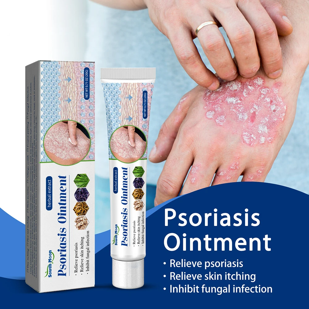 Psoriasis Cream For Removing Psoriasis Eczema Anti Psoriasis Dermatitis