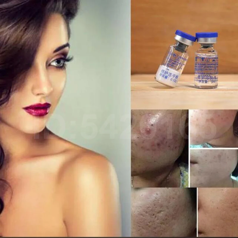 80000 Units EGF Serum Repairing Damaged Skin Acne Treatment Liquid Face Serum Skin Care Products Korean cosmetics 6