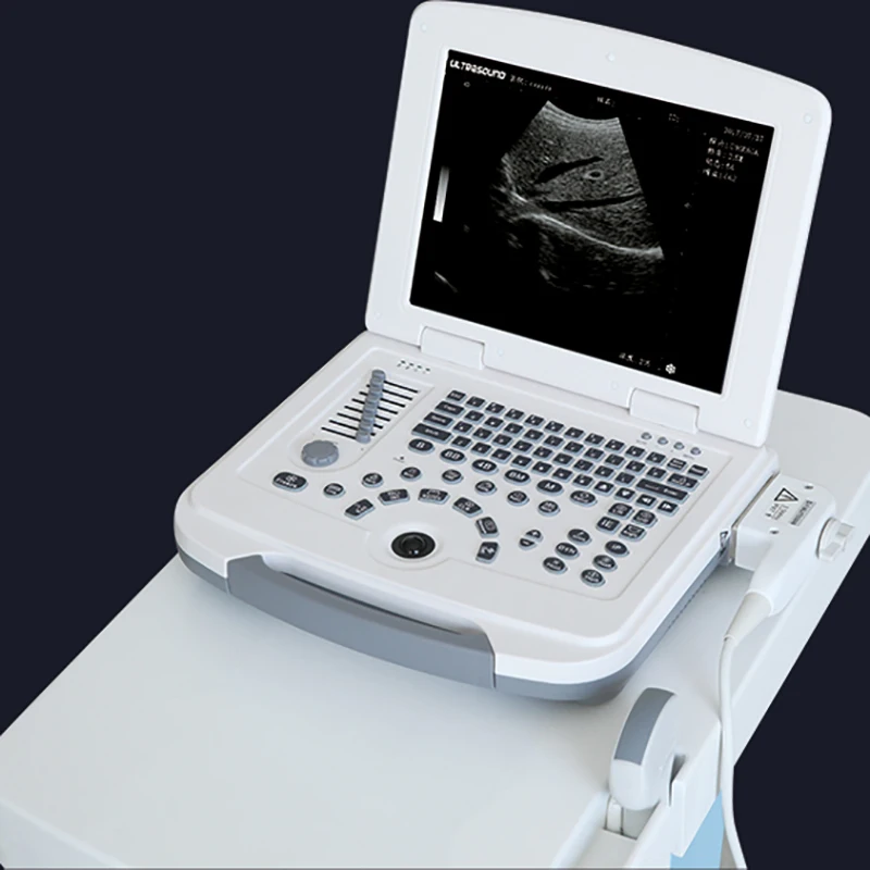 

New Medical Portable Color Doppler Ultrasound for Hospital