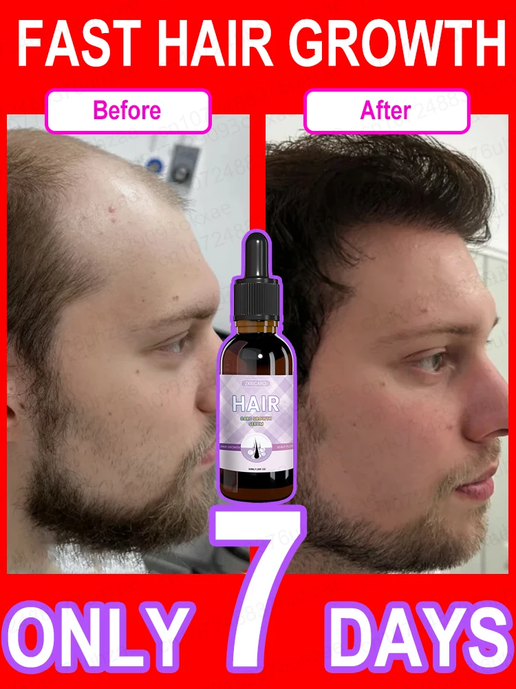 Hair growth essential oil Effectively repairs baldness and hair loss symptoms suitable for both men and women hair growth serum hair growth cream hair growth spray hair growth shampoo set hair care oil