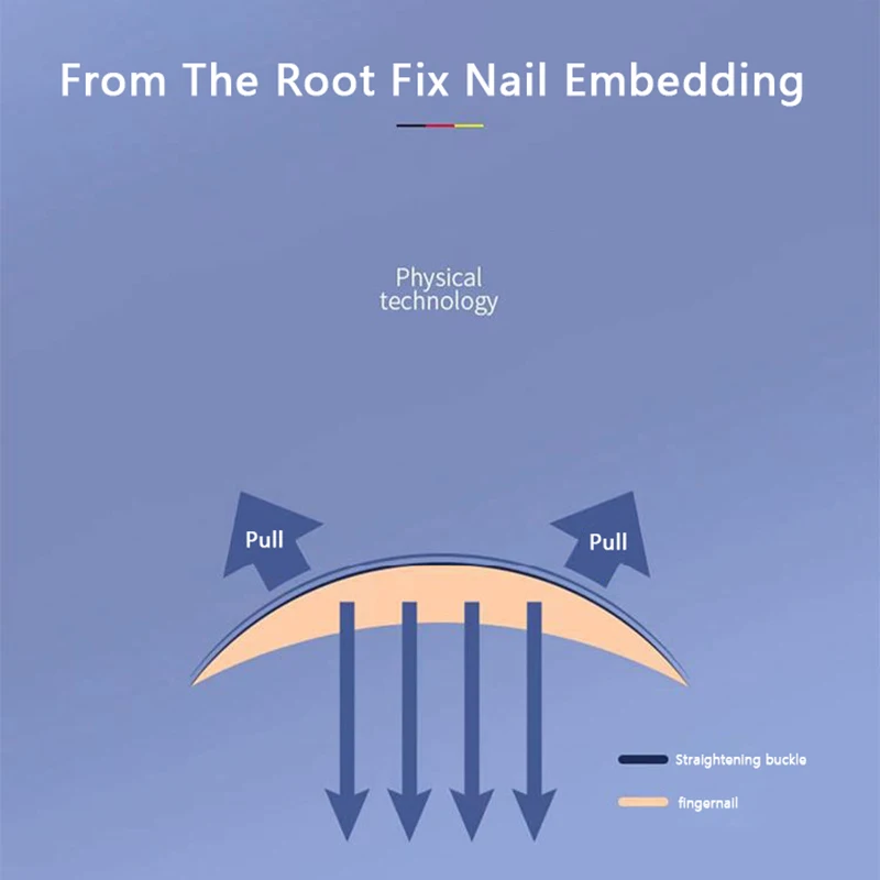Ingrown Toenail Corrector Tools Pedicure Recover Embed Toe Nail Treatment Professional Ingrown Toenail Correction Foot CareTool toe corrector foot care tool ingrown toenail correction tool foot pedicure tool mens foot care product