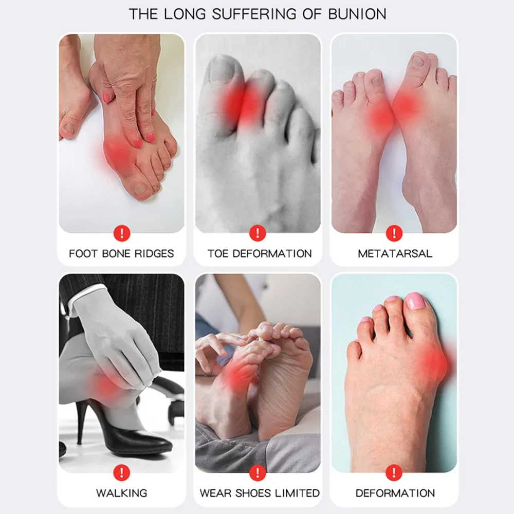 Toe Separators Toe Corrector Toe Protector Big Toe Bunion Corrector Adjustable Orthopedic Socks Hallux Valgus Feet Protector Foot Care Tools