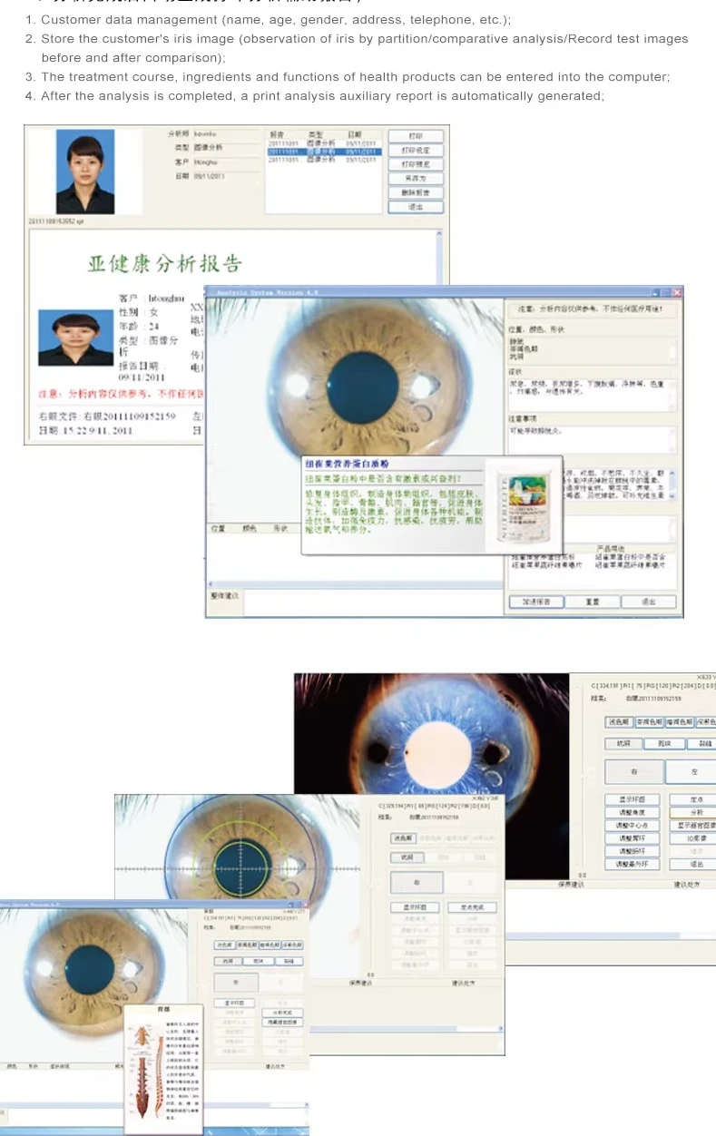 HD 홍채 분석기 홍채 및 안막 확대경 눈 건강 및 건강상태 검사기 공장 직공급