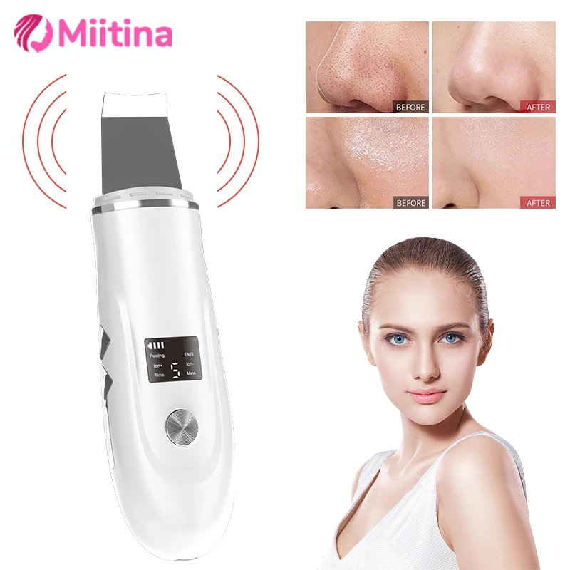 Electric Ultrasonic Skin Scrubber Peeling Shovel Blackhead Remove Pores Deep Cleaning Peeling Sholve Skin Care Face Lifting