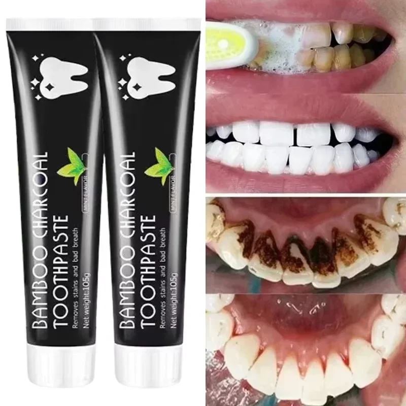 Toothpaste Whitening Remove Yellow Teeth Adsorbs Bad Breath Cleaning Teeth Stains Oral Care teeth whitening product teeth whitening essence