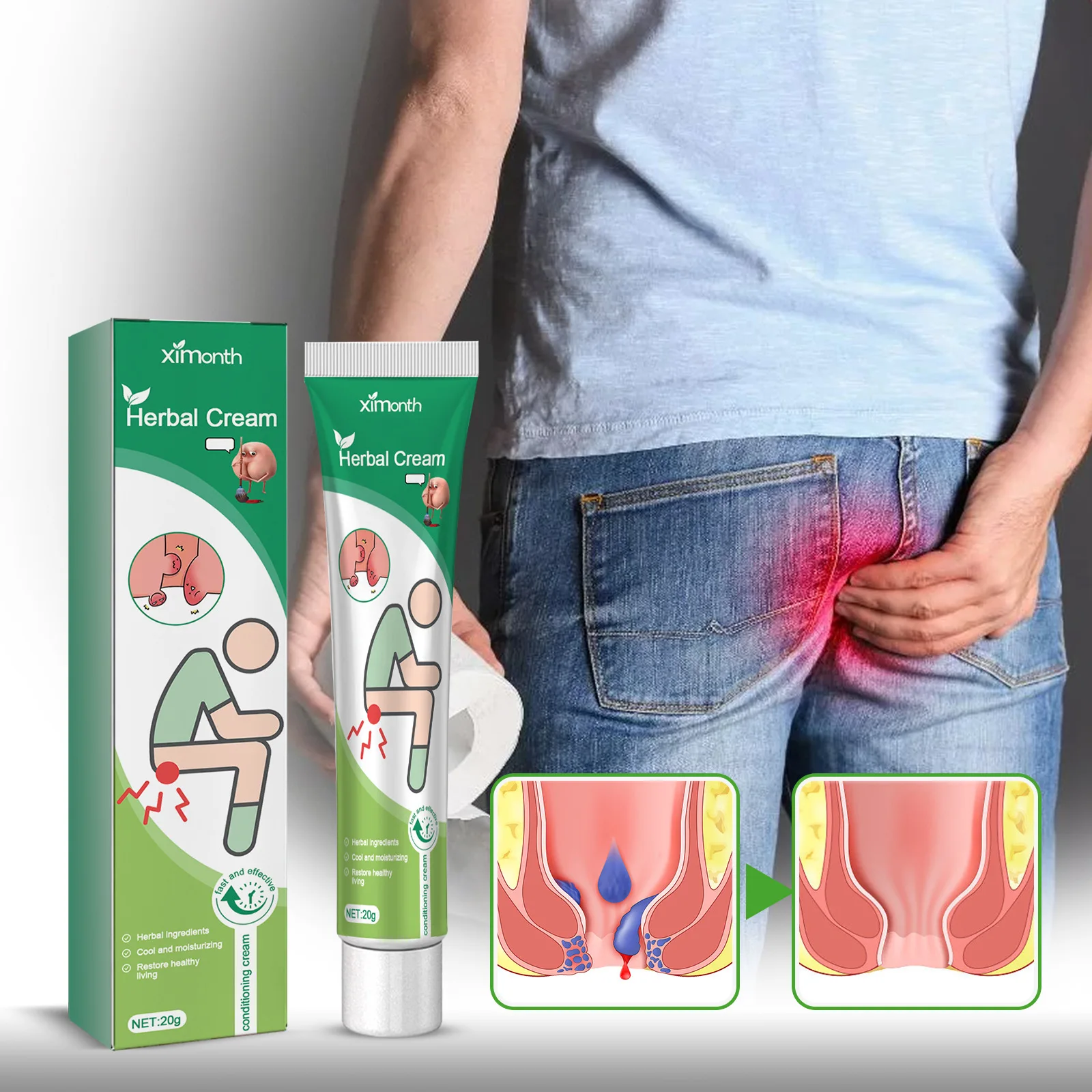 Hemorrhoid Ointment Anal Fissure Therapy Pain Relief Reduce Swell Bleed Treat Internal External Hemorrhoid Cream Health Care