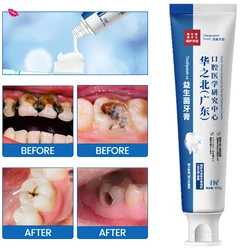 2023 Quick Repair of Cavities Caries Removal of Plaque Stains Decay Whitening Yellowing Repair Teeth Teeth Whitening New Upgrade