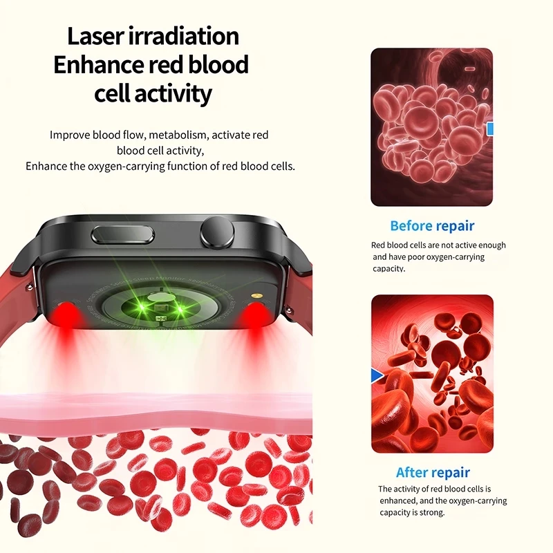 Painless ħ  Ʈ ġ   ġ ǰ   Smartwatch  Glucometer ð