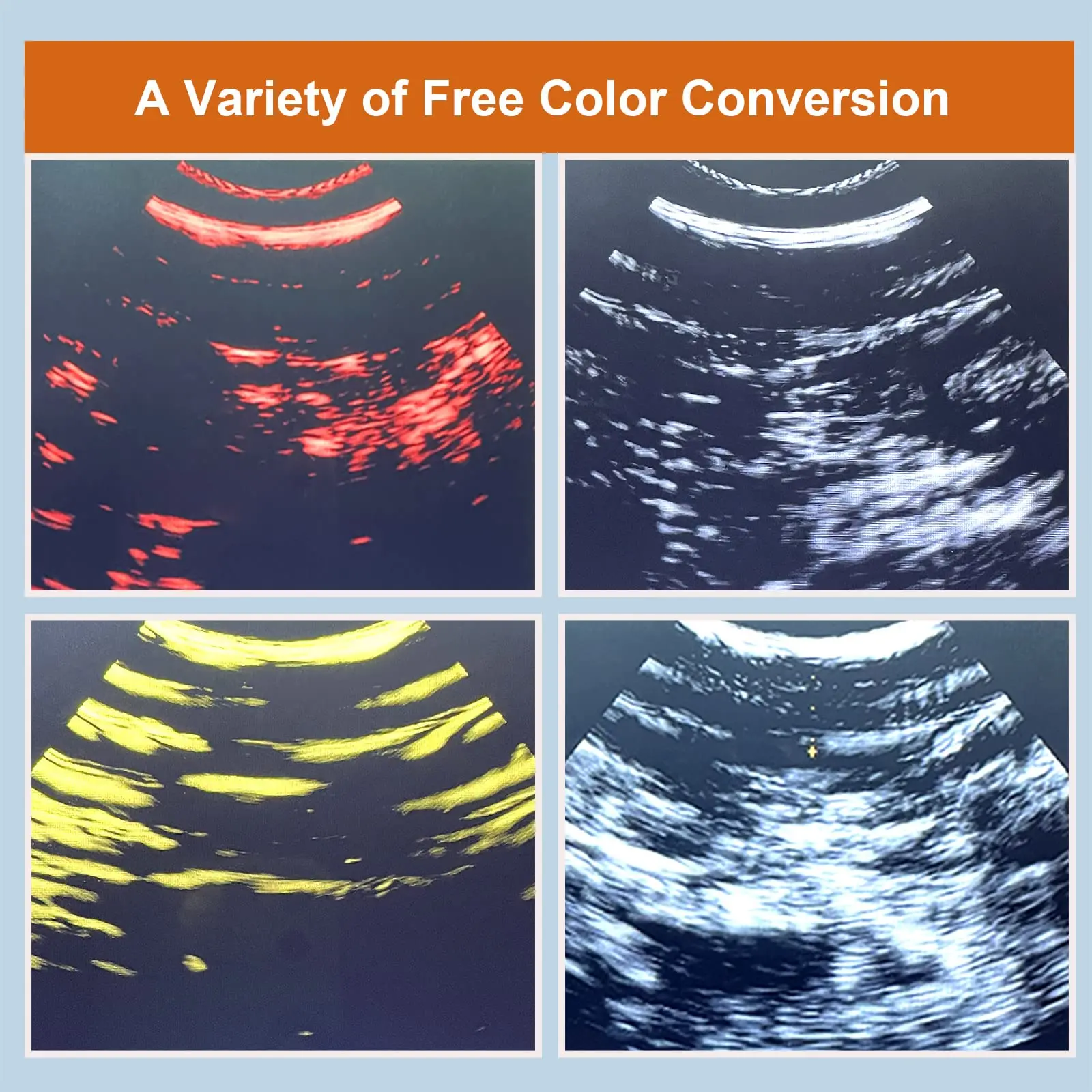 Wireless Mechanical Veterinary Ultrasound Scanner Portable Pregnancy Test Handheld Ultrasound Machine Pig Sheep