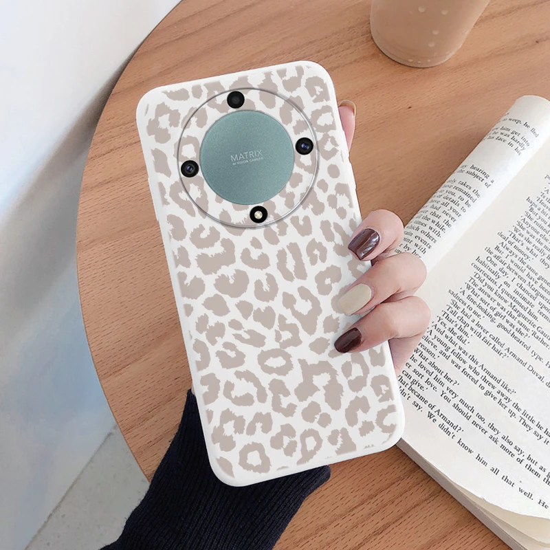 Für Honor X9a X9b X9c Magic5 6 7 Lite 5G Fall Mode Leopard Print Zurück Abdeckung Weiche TPU stoßfest Funda Marmor Textur Shell – Detail 4