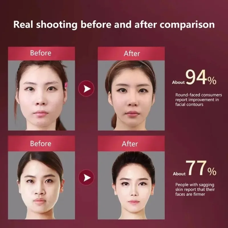 LED Photon Therapy Facial Slimming Vibration Massager Facial Lifting Device Heated Double Chin V Face Vibration Massager