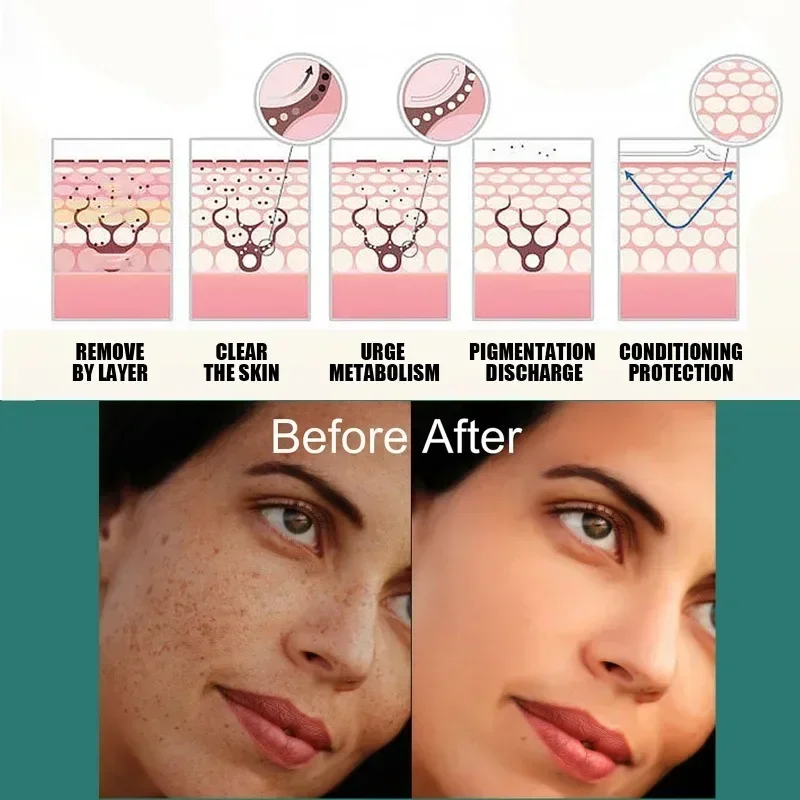 Facial Serum Makeup Cream Anti Wrinkle Cream Niacinamide Melasma Brightening Cream Reduce Melanin Brighten Lighten Dark Skin Chloasma Serum Fade Fine Face Lines