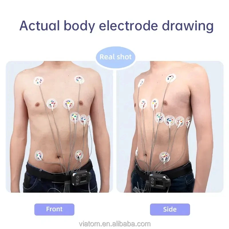 Bluetooth electrocardiogram monitor 12 lead dynamic electrocardiogram 24-hour monitoring heart data storage ma