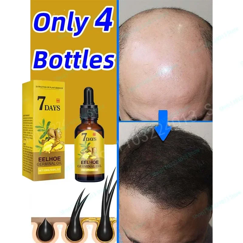 

Fast hair growth promoter products Hair loss Hereditary Seborrheic alopecia treatment oil For Hair growth essence Natural safety