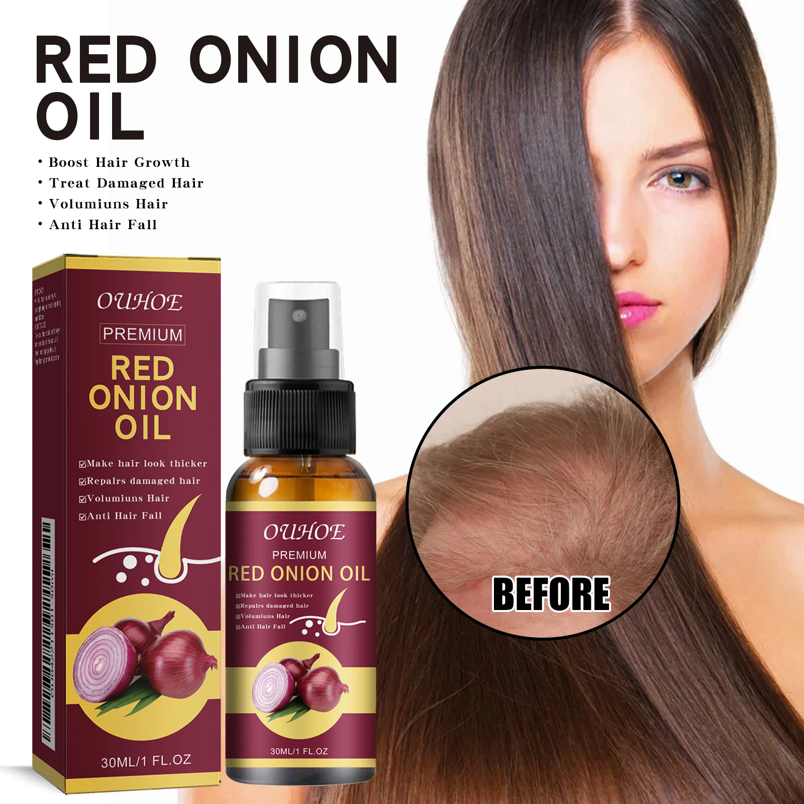 Hair Growth Oil Red Onion Hair Growth Essential Oil Hair Care Spray Prevent Loss Nourish Roots