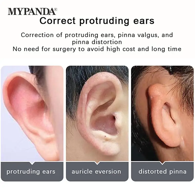 Ear Corrector 2-8Pcs Elf Ear Plasters