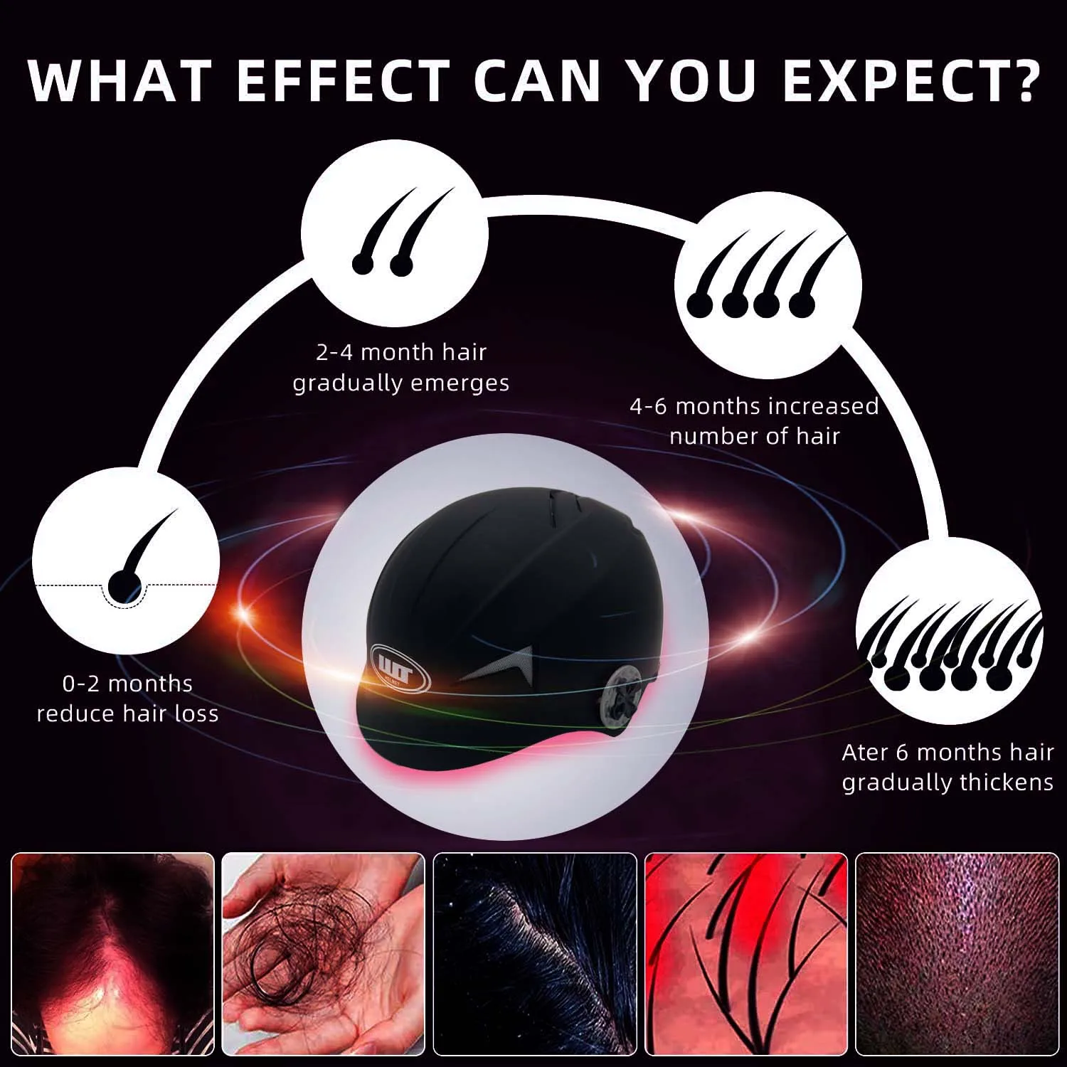 LLLT low leve laser 650nm hair loss products 4