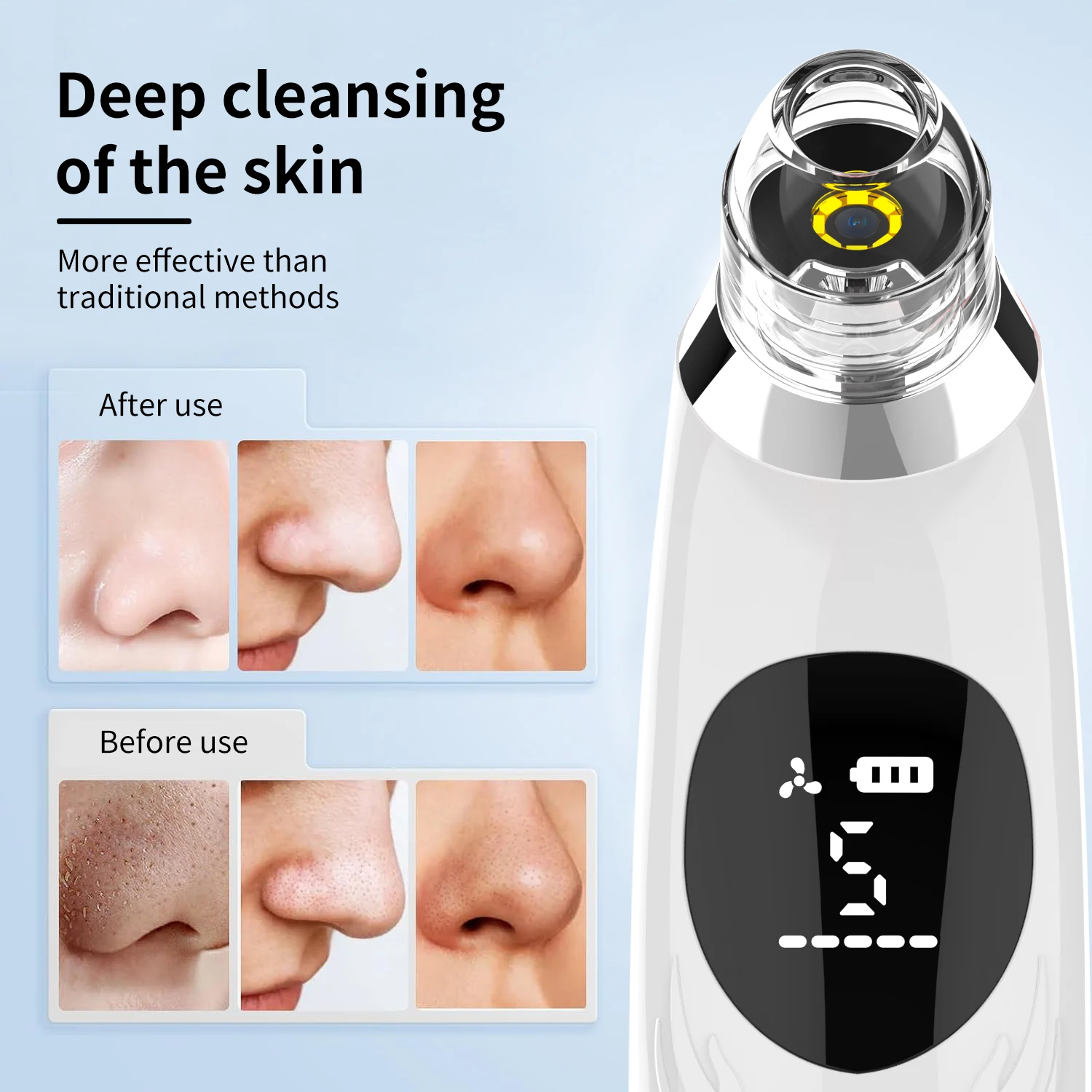 Facial Beauty Instrument Blackhead Remover Blackhead Instrument Skin Care Device Blackhead Remover Pore Vacuum with Camera Upgraded Black Head Remover for Face 5 Modes 3 Probes Pimple Popper Tool Kit