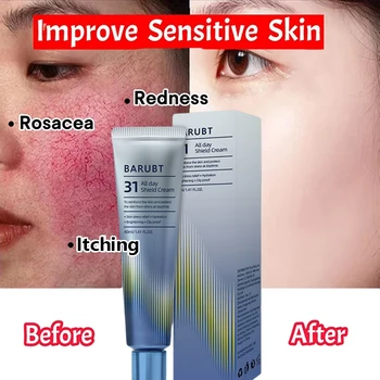 Riparazione Crema Rosacea Viso Istantanea Veine di Ragno Rimuovere Pelle Sensibile Lenisce Anti Rosacea Trattare Lozione Cosmetici Coreani 1