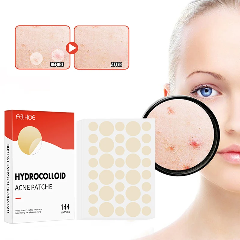 Star Shape Acne Treatment Hydrocolloid Pimple Patches Packed with Cosmetic  Mirror Case - China Acne Patches, Hydrocolloid