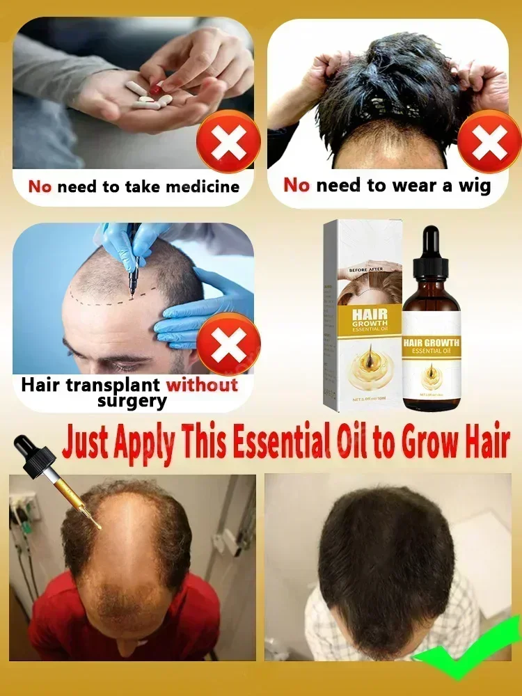 Powerful Hair Growth Serum Oil Nourish Root Regrowth Hair Anti Hair Loss Treatment Essence For Men Women 5