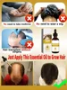 Powerful Hair Growth Serum Oil Nourish Root Regrowth Hair Anti Hair Loss Treatment Essence For Men Women 5