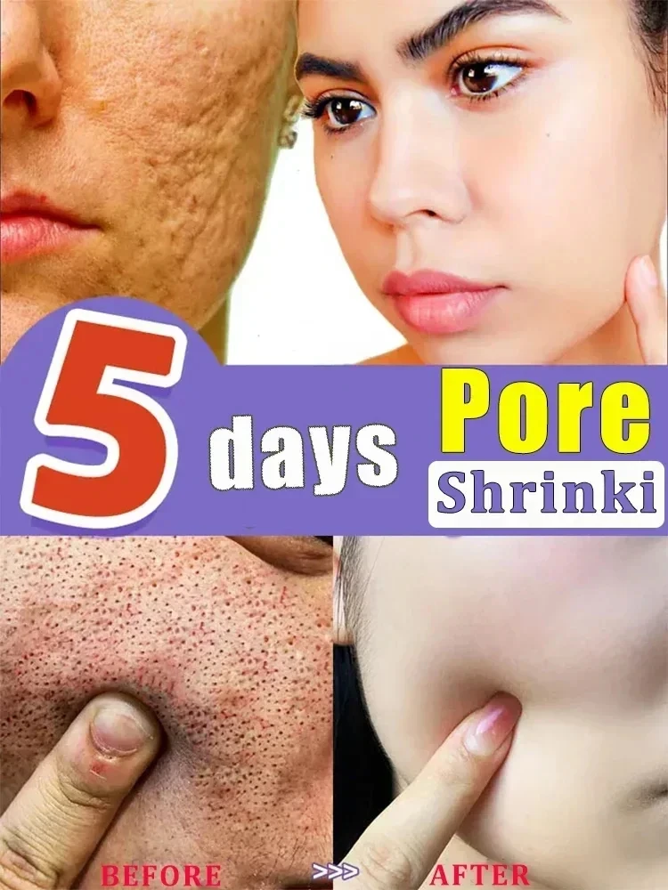 Lactobionic Acid Pore Shrink Face Serum Hyaluronic Acid Moisturizing Nourishing Essence Firming Brighten Beauty Korean Cosmetics 2