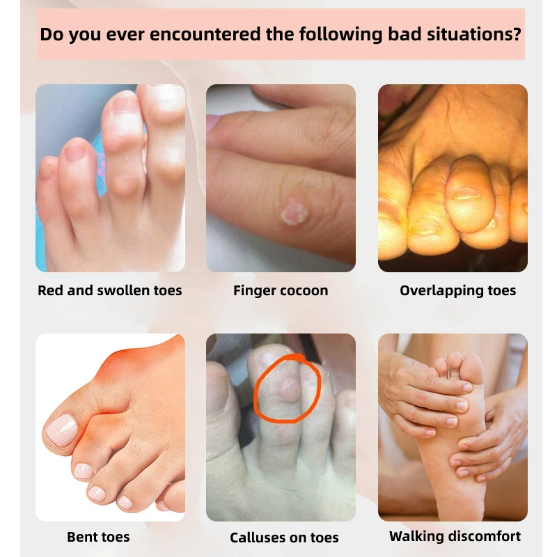 Toe Protectors 2/4/6pcs Silicone Gel Toe Protection Sleeve Pedicure Little Finger Tube Corns Blisters Bunion Corrector Pinkie Protector