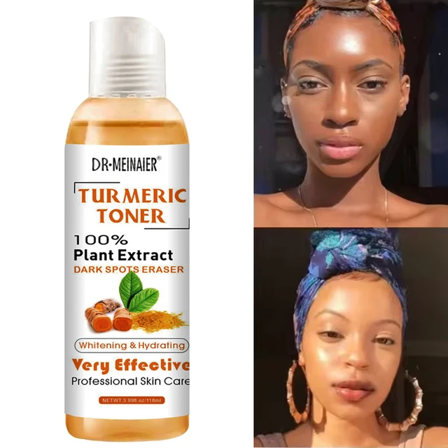 Sérum éclaircissant pour le visage, tonique au curcuma, correcteur foncé, hydratant, vitamine C, Essence de gingembre, cosmétiques coréens 1
